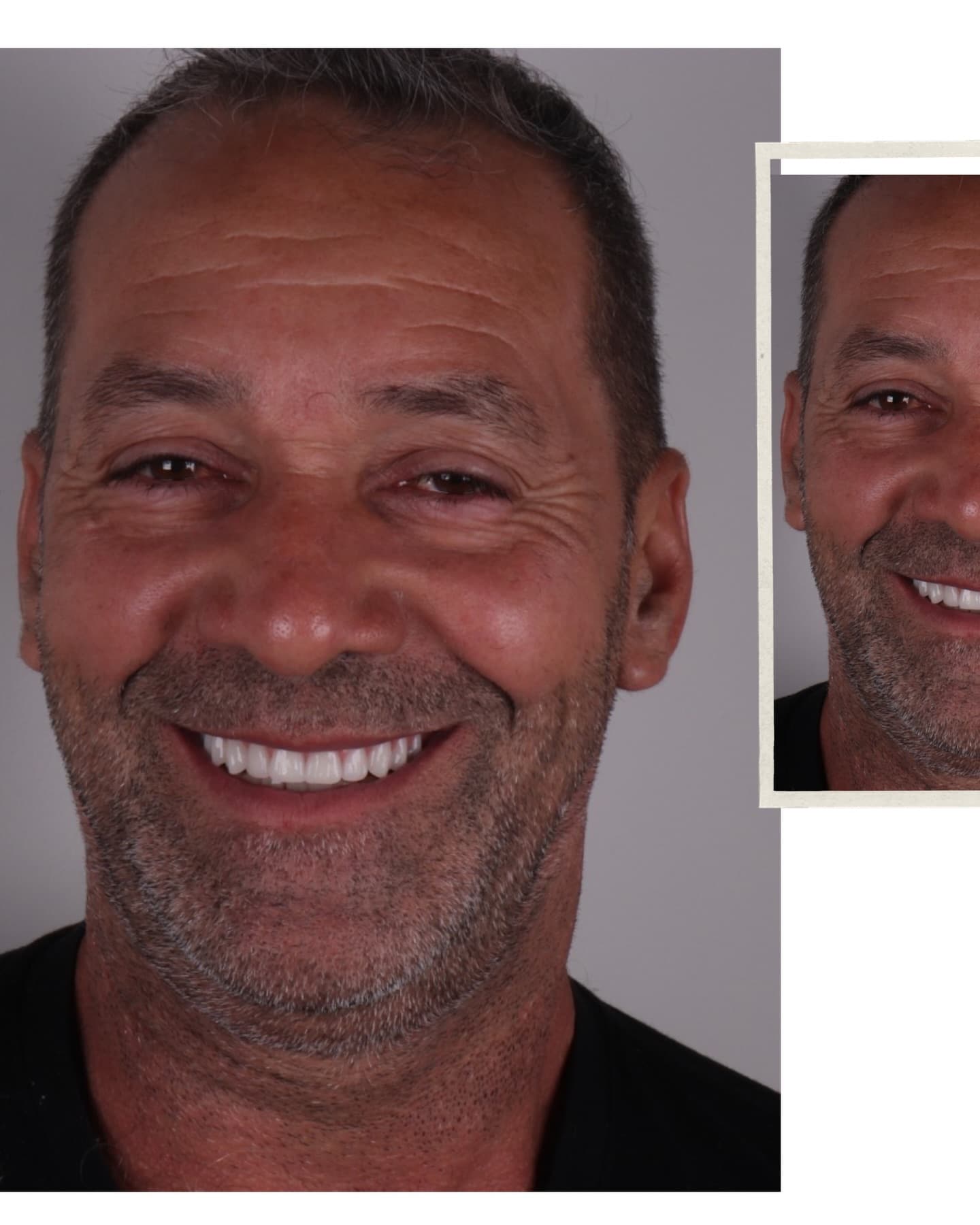 Depois — Resultado real