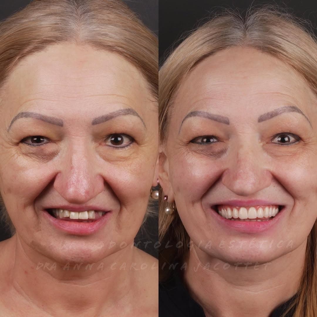 Depois — Transformação odontológica